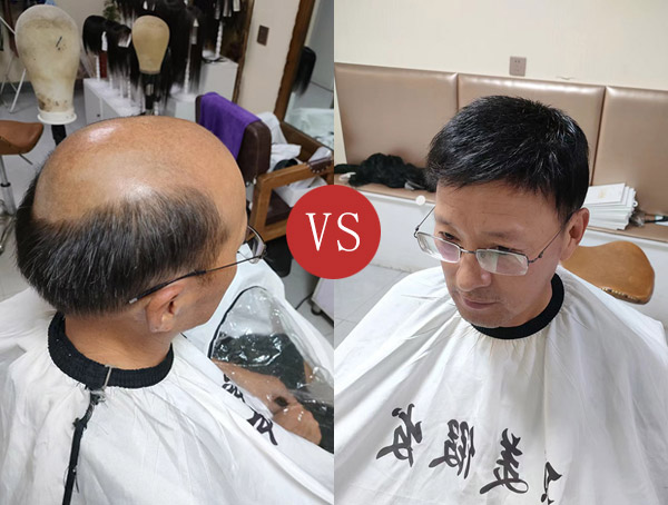 男士假发定制
