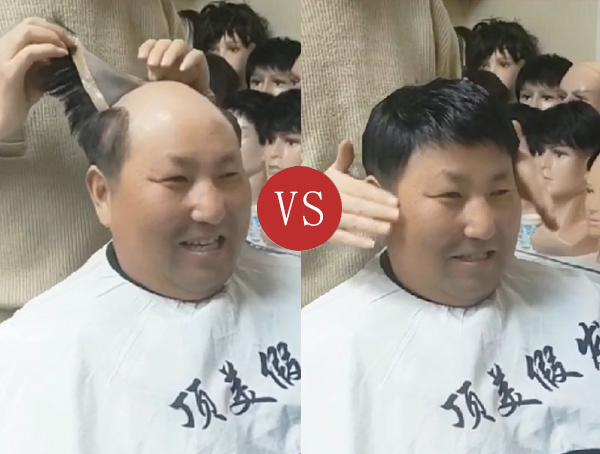 南阳男士假发定制案例